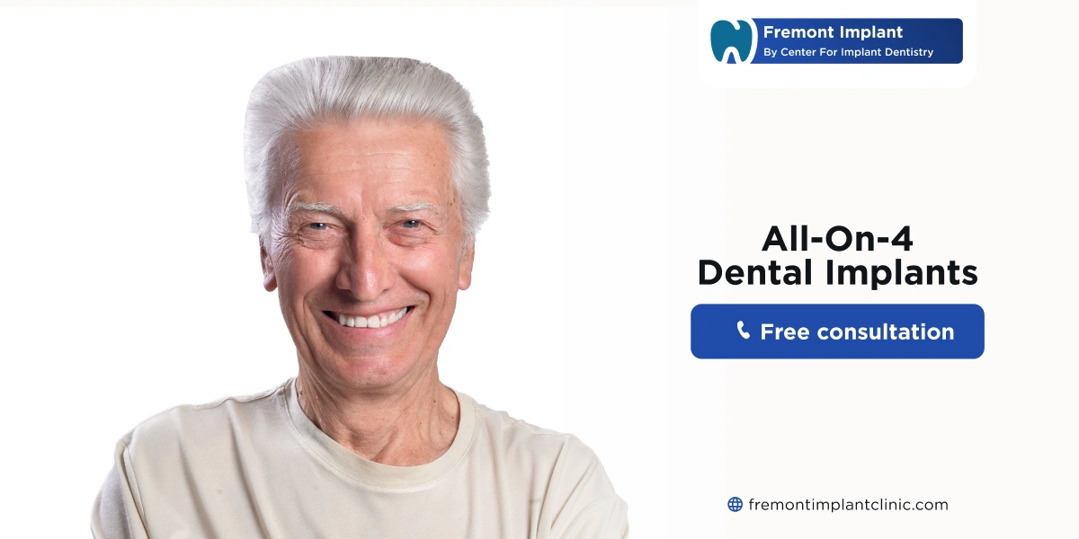 All on 4 Dental Implants