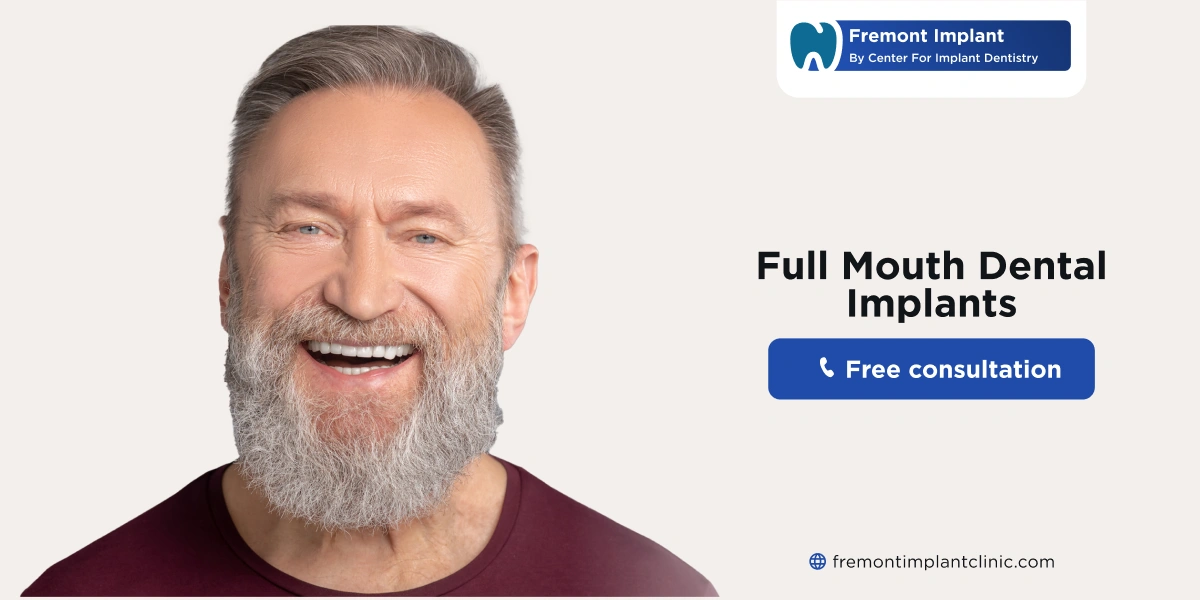 True Cost of Full Mouth Dental Implants
