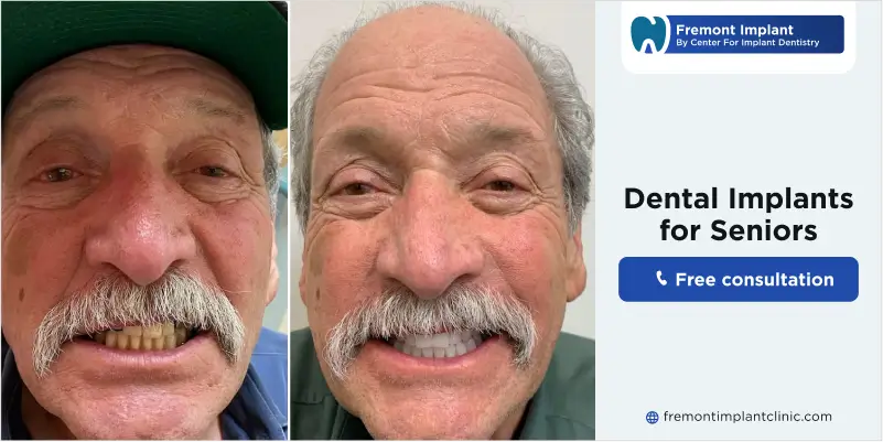dental implants for seniors