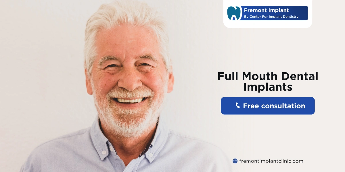 Full-Mouth Dental Implants Cost